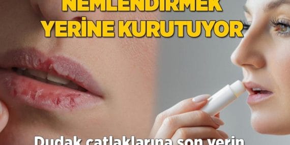 Dudaklarınızı Doğru Nemlendirin: Kuruluğa Son!