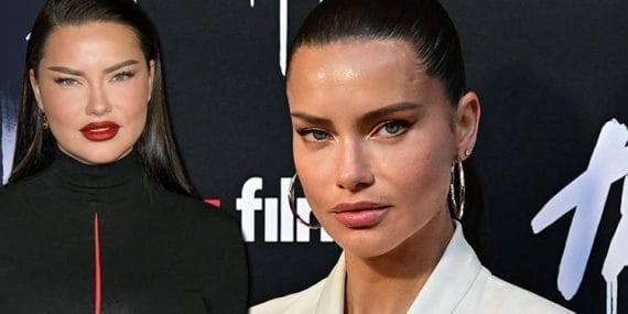 Adriana Lima’nın Estetik Tartışmaları ve Dönüşümü