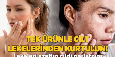 tek-urunle-inatci-lekeler-ucup-gidecek-IeZHGQlH.jpg