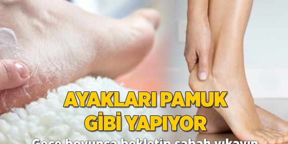 ayaklari-pamuk-gibi-yapiyor-gece-boyunca-bekletip-sabah-yikayin-ICVYHt3j.jpg