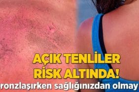 acik-tenliler-risk-altinda-bronzlasirken-sagliginizdan-olmayin-29pDaBBJ.jpg