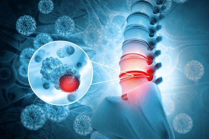 Bel Ağrıları: Nedenleri, Risk Faktörleri ve Önleme Yöntemleri