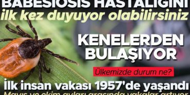 kene-kaynakli-hastaliklar-babesiosis-hakkinda-bilmeniz-gerekenler-AtMAb9Q2.jpg