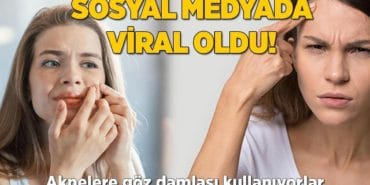 sosyal-medyada-yeni-trend-akneler-icin-goz-damlasi-mucizesi-mi-M8xvUhn3.jpg