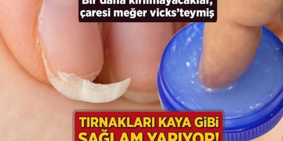 Tırnakları kaya gibi sağlam yapıyor! Kırılmaya son, çözüm meğer vicks’teymiş