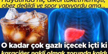 paulun-karaciger-nakli-hikayesi-sagliksiz-yasam-tarzinin-sonuclari-QlTpH6d7.jpg