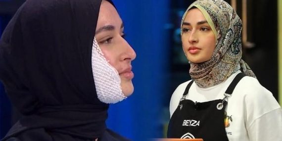 MasterChef Beyza şiddete uğradığını itiraf etti! ‘Yüzümde dayak izleri vardı’